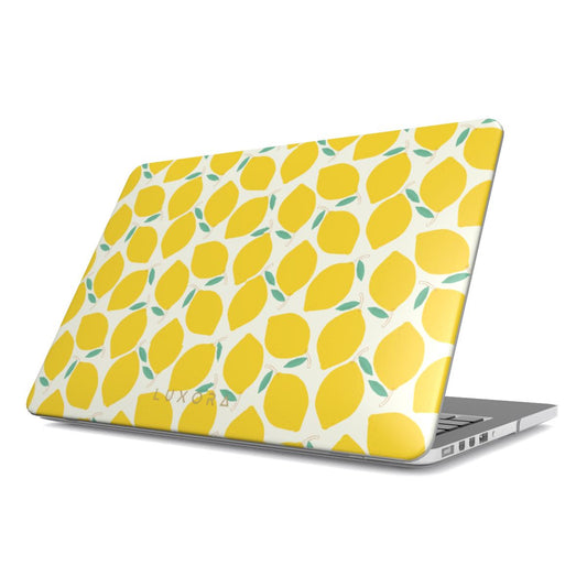 MacBook Case - Luxora