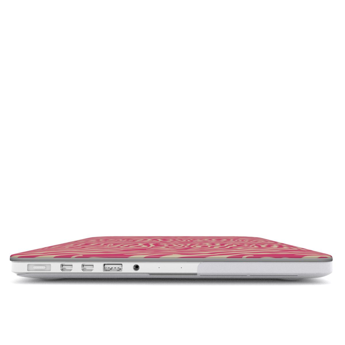 MacBook Case - Luxora