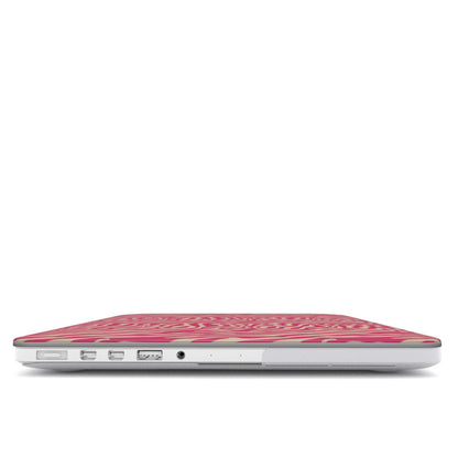 MacBook Case - Luxora